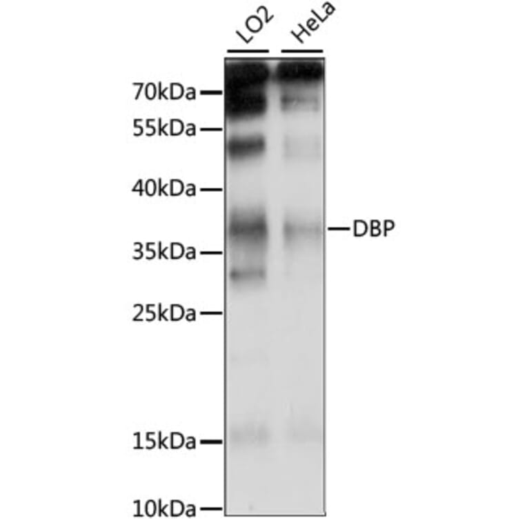 Western Blot - Anti-D Box Binding Protein Antibody (A89473) - Antibodies.com
