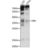 Western Blot - Anti-D Box Binding Protein Antibody (A89473) - Antibodies.com