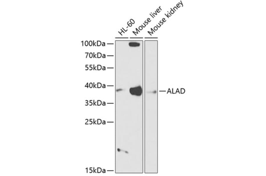 Western Blot - Anti-ALAD Antibody (A89474) - Antibodies.com