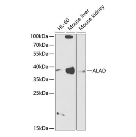 Western Blot - Anti-ALAD Antibody (A89474) - Antibodies.com