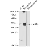 Western Blot - Anti-ALAD Antibody (A89474) - Antibodies.com