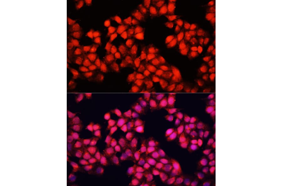 Immunofluorescence - Anti-ALAD Antibody (A89474) - Antibodies.com