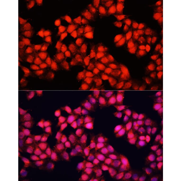 Immunofluorescence - Anti-ALAD Antibody (A89474) - Antibodies.com