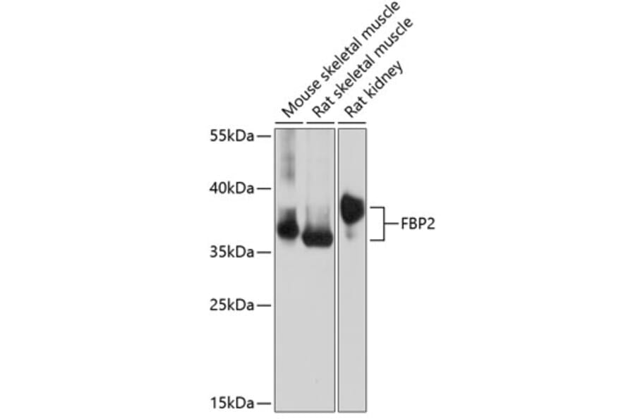 Western Blot - Anti-FBP2 Antibody (A89475) - Antibodies.com