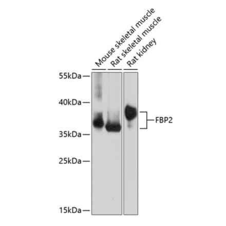 Western Blot - Anti-FBP2 Antibody (A89475) - Antibodies.com