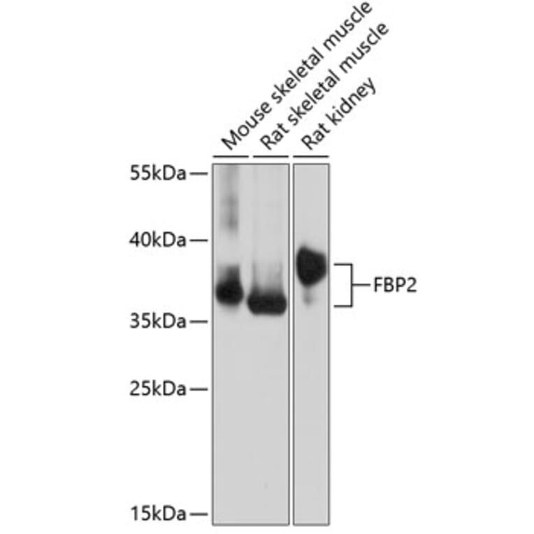 Western Blot - Anti-FBP2 Antibody (A89475) - Antibodies.com