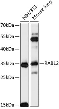 Western blot analysis of extracts of various cell lines, using Anti-RAB12 Antibody (A14320) at 1:3000 dilution.
Secondary antibody: Goat Anti-Rabbit IgG (H+L) (HRP) (AS014) at 1:10,000 dilution.
Lysates / proteins: 25µg per lane.
Blocking buffer: 3% non-fat dry milk in TBST.
Detection: ECL Basic Kit (RM00020).
Exposure time: 60s.