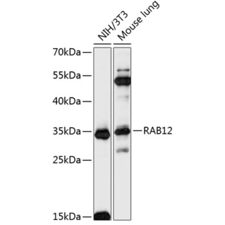 Western Blot - Anti-RAB12 Antibody (A89476) - Antibodies.com