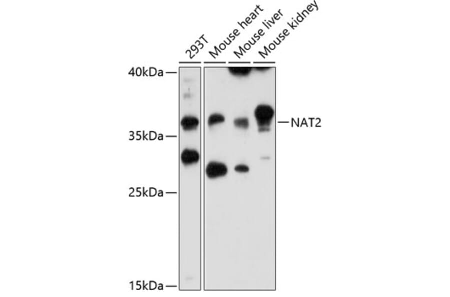 Western Blot - Anti-NAT2/AT-2 Antibody (A89477) - Antibodies.com