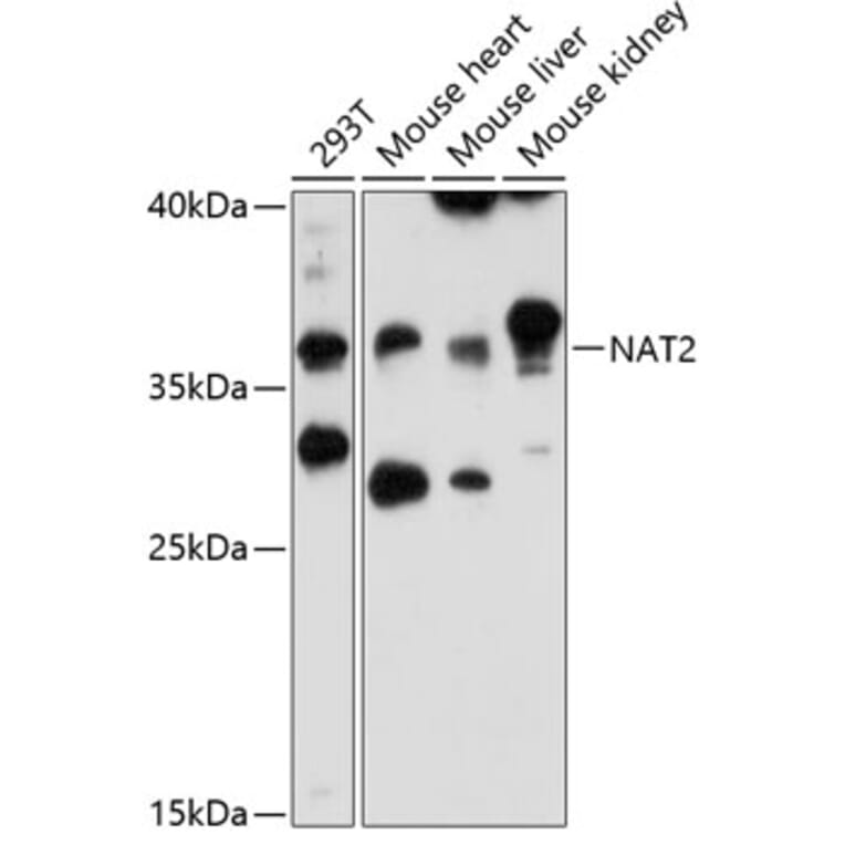 Western Blot - Anti-NAT2/AT-2 Antibody (A89477) - Antibodies.com