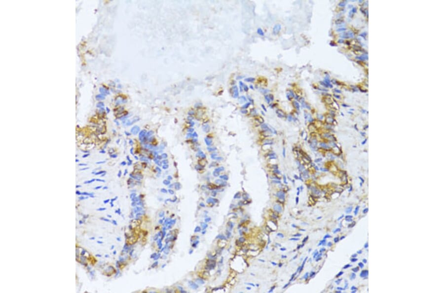 Immunohistochemistry - Anti-NAT2/AT-2 Antibody (A89477) - Antibodies.com
