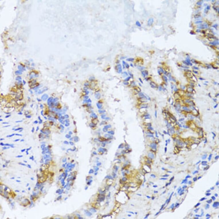 Immunohistochemistry - Anti-NAT2/AT-2 Antibody (A89477) - Antibodies.com