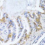 Immunohistochemistry - Anti-NAT2/AT-2 Antibody (A89477) - Antibodies.com