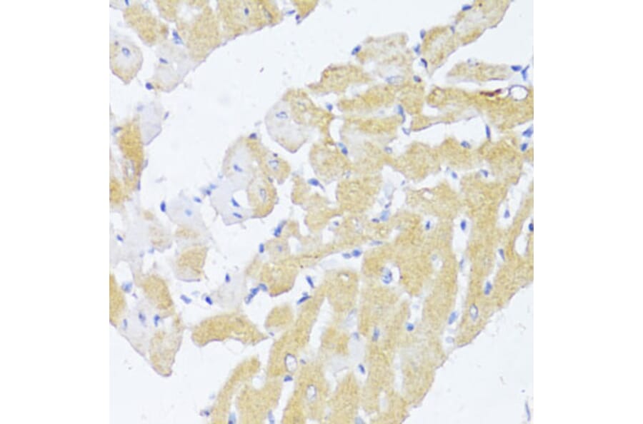 Immunohistochemistry - Anti-NAT2/AT-2 Antibody (A89477) - Antibodies.com