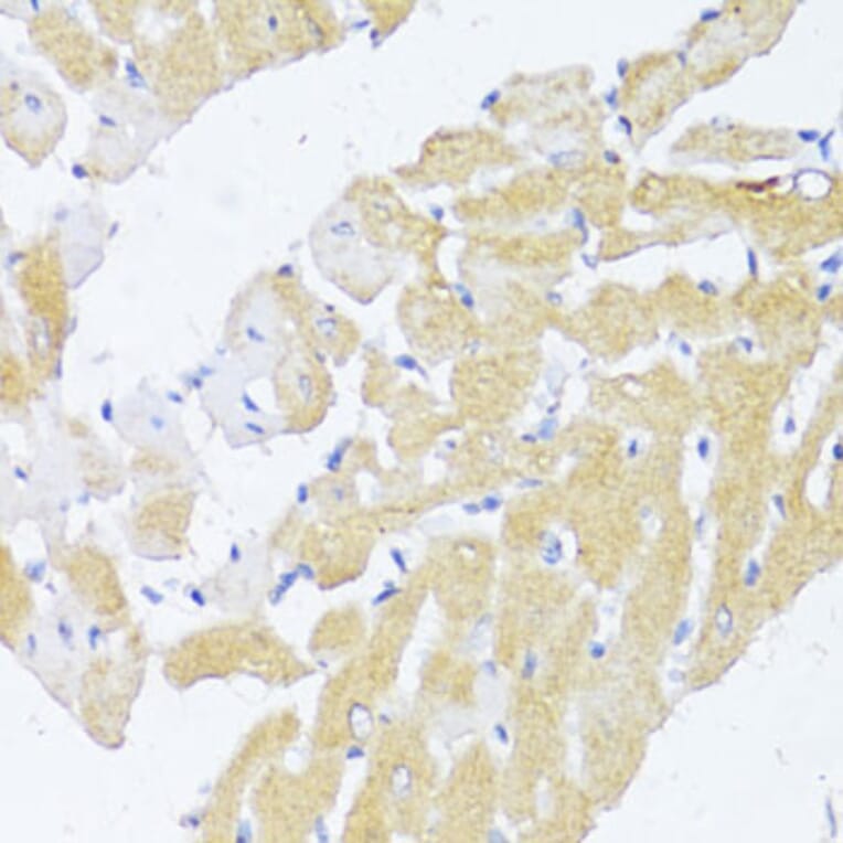 Immunohistochemistry - Anti-NAT2/AT-2 Antibody (A89477) - Antibodies.com