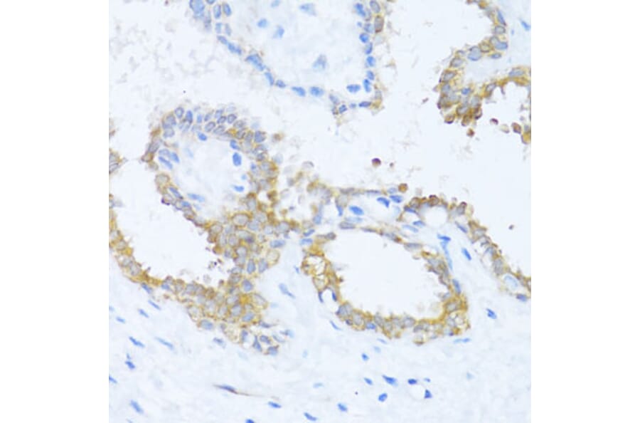 Immunohistochemistry - Anti-NAT2/AT-2 Antibody (A89477) - Antibodies.com