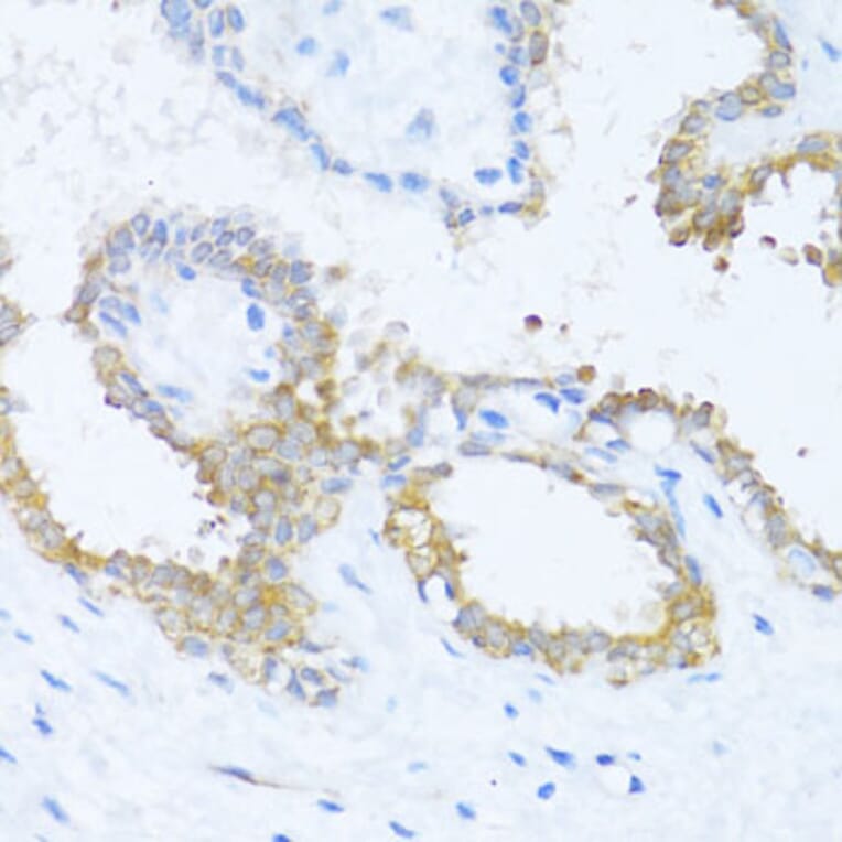 Immunohistochemistry - Anti-NAT2/AT-2 Antibody (A89477) - Antibodies.com