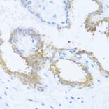 Immunohistochemistry - Anti-NAT2/AT-2 Antibody (A89477) - Antibodies.com