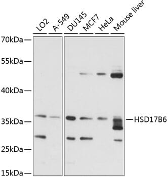 Western blot analysis of extracts of various cell lines, using Anti-HSD17B6 Antibody (A14474) at 1:1,000 dilution.
Secondary antibody: Goat Anti-Rabbit IgG (H+L) (HRP) (AS014) at 1:10,000 dilution.
Lysates / proteins: 25µg per lane.
Blocking buffer: 3% non-fat dry milk in TBST.
Detection: ECL Basic Kit (RM00020).
Exposure time: 10s.