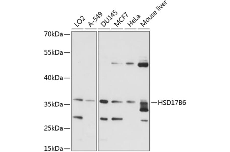 Western Blot - Anti-HSD17B6 Antibody (A89478) - Antibodies.com