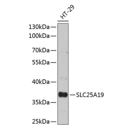 Western Blot - Anti-SLC25A19 Antibody (A89479) - Antibodies.com