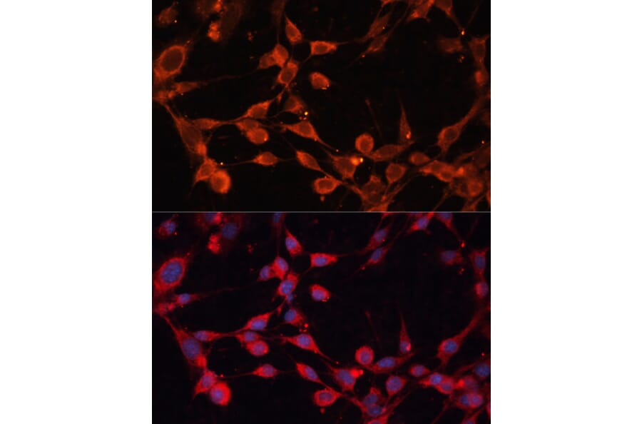 Immunofluorescence - Anti-SLC25A19 Antibody (A89479) - Antibodies.com