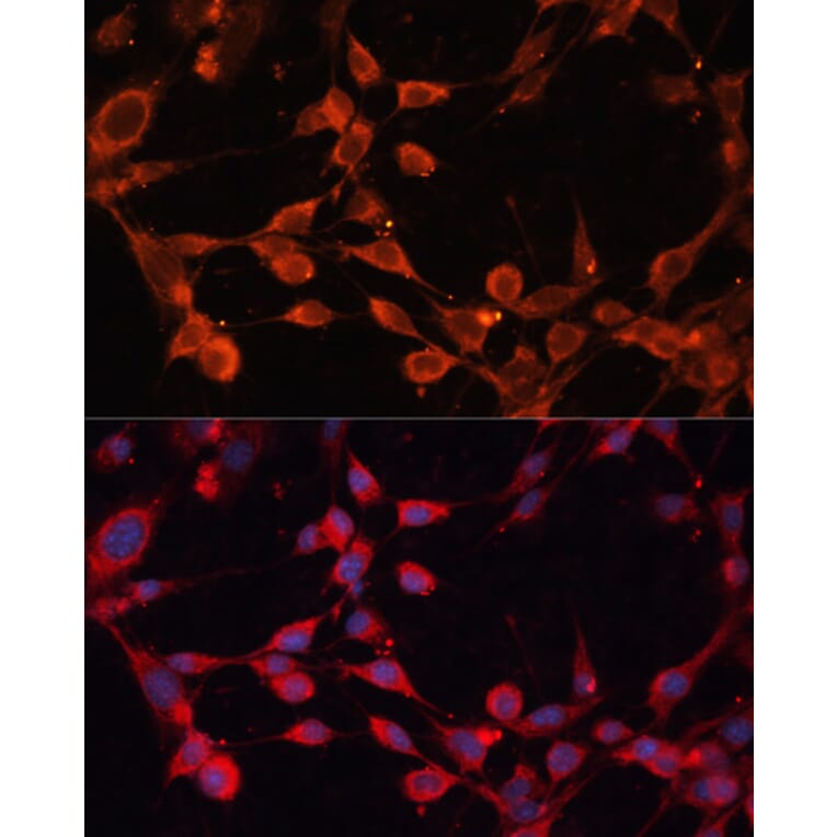 Immunofluorescence - Anti-SLC25A19 Antibody (A89479) - Antibodies.com
