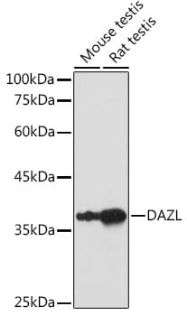 Western blot analysis of extracts of various cell lines, using Anti-DAZL Antibody (A13970) at 1:1,000 dilution.
Secondary antibody: Goat Anti-Rabbit IgG (H+L) (HRP) (AS014) at 1:10,000 dilution.
Lysates / proteins: 25µg per lane.
Blocking buffer: 3% non-fat dry milk in TBST.
Detection: ECL Basic Kit (RM00020).
Exposure time: 30s.