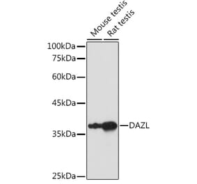 Western Blot - Anti-DAZL Antibody (A89480) - Antibodies.com