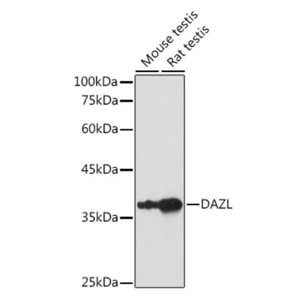 Western Blot - Anti-DAZL Antibody (A89480) - Antibodies.com