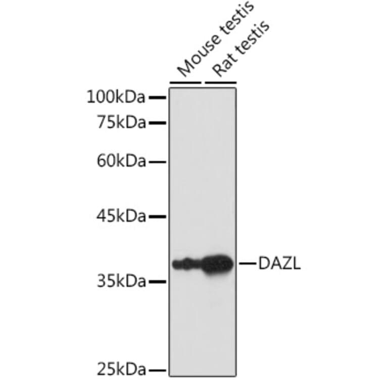 Western Blot - Anti-DAZL Antibody (A89480) - Antibodies.com