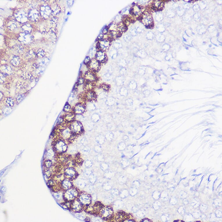 Immunohistochemistry - Anti-DAZL Antibody (A89480) - Antibodies.com