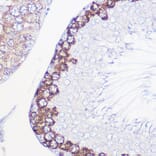 Immunohistochemistry - Anti-DAZL Antibody (A89480) - Antibodies.com