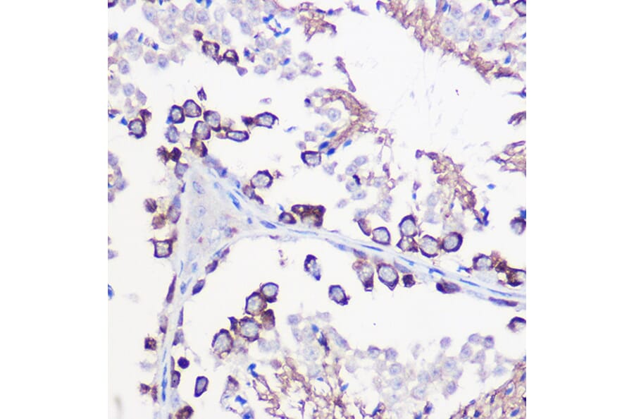 Immunohistochemistry - Anti-DAZL Antibody (A89480) - Antibodies.com