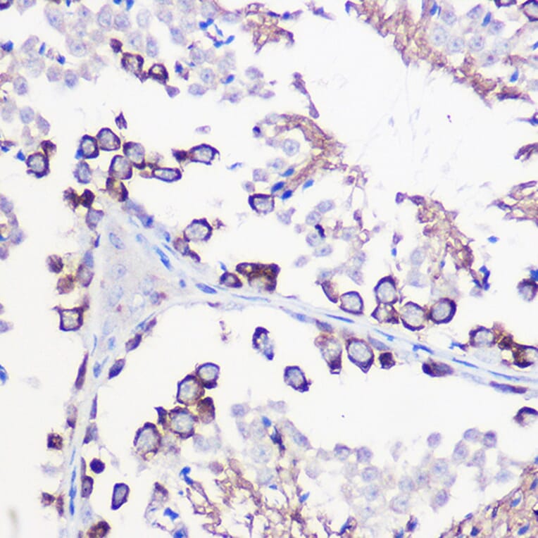 Immunohistochemistry - Anti-DAZL Antibody (A89480) - Antibodies.com