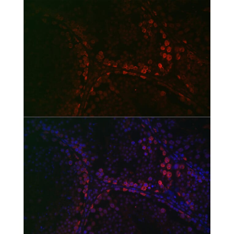 Immunofluorescence - Anti-DAZL Antibody (A89480) - Antibodies.com