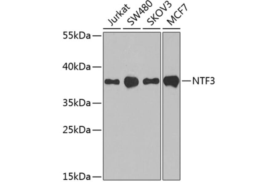 Western Blot - Anti-Neurotrophin 3 Antibody (A89482) - Antibodies.com