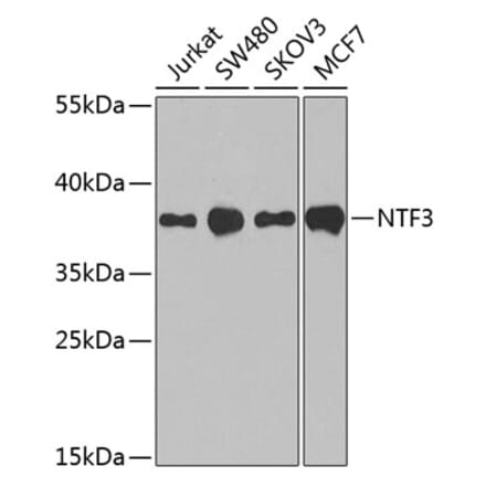 Western Blot - Anti-Neurotrophin 3 Antibody (A89482) - Antibodies.com