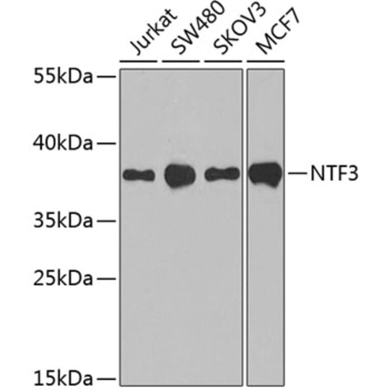 Western Blot - Anti-Neurotrophin 3 Antibody (A89482) - Antibodies.com