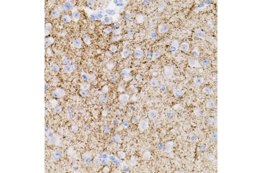 Immunohistochemistry - Anti-Neurotrophin 3 Antibody (A89482) - Antibodies.com