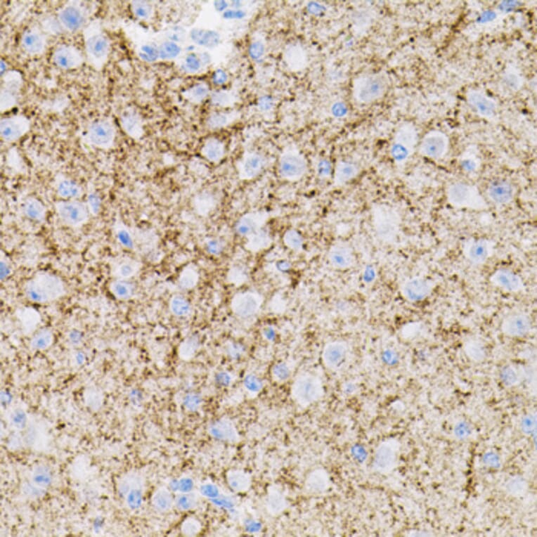 Immunohistochemistry - Anti-Neurotrophin 3 Antibody (A89482) - Antibodies.com