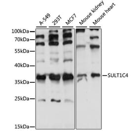 Western Blot - Anti-SULT1C4 Antibody (A89483) - Antibodies.com