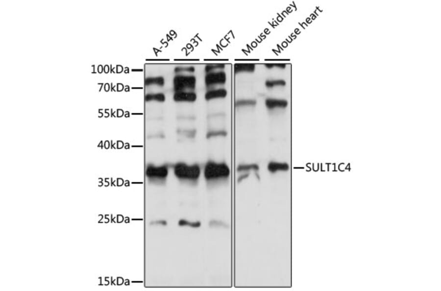 Western Blot - Anti-SULT1C4 Antibody (A89483) - Antibodies.com