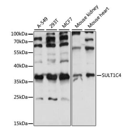 Western Blot - Anti-SULT1C4 Antibody (A89483) - Antibodies.com