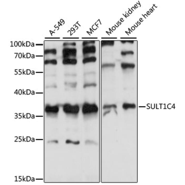 Western Blot - Anti-SULT1C4 Antibody (A89483) - Antibodies.com