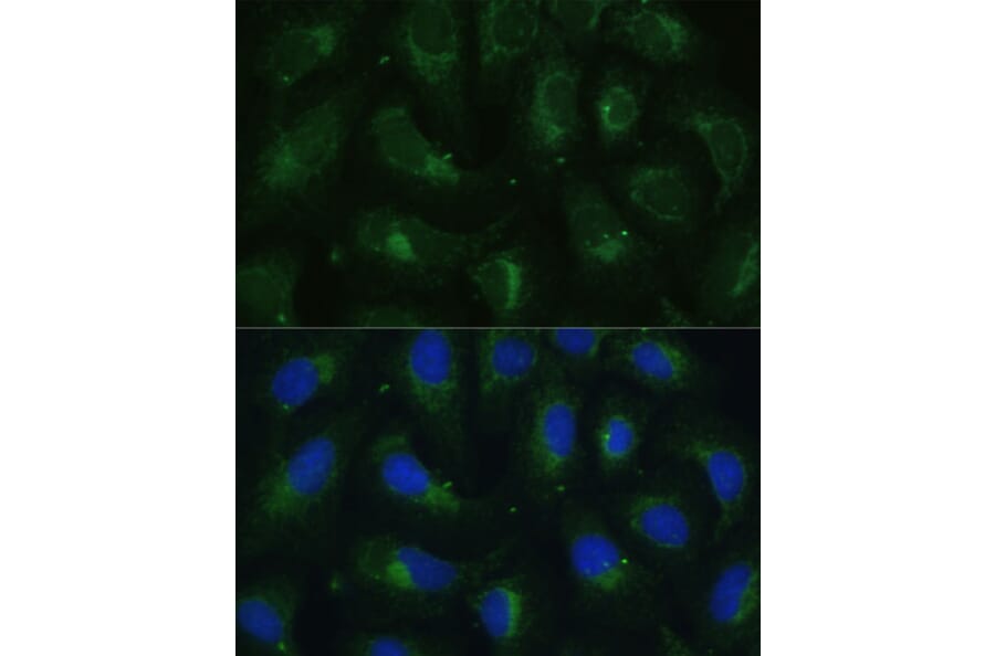 Immunofluorescence - Anti-SULT1C4 Antibody (A89483) - Antibodies.com