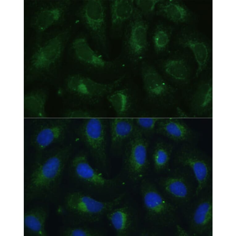 Immunofluorescence - Anti-SULT1C4 Antibody (A89483) - Antibodies.com