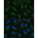 Immunofluorescence - Anti-SULT1C4 Antibody (A89483) - Antibodies.com