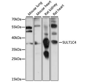 Western Blot - Anti-SULT1C4 Antibody (A89484) - Antibodies.com