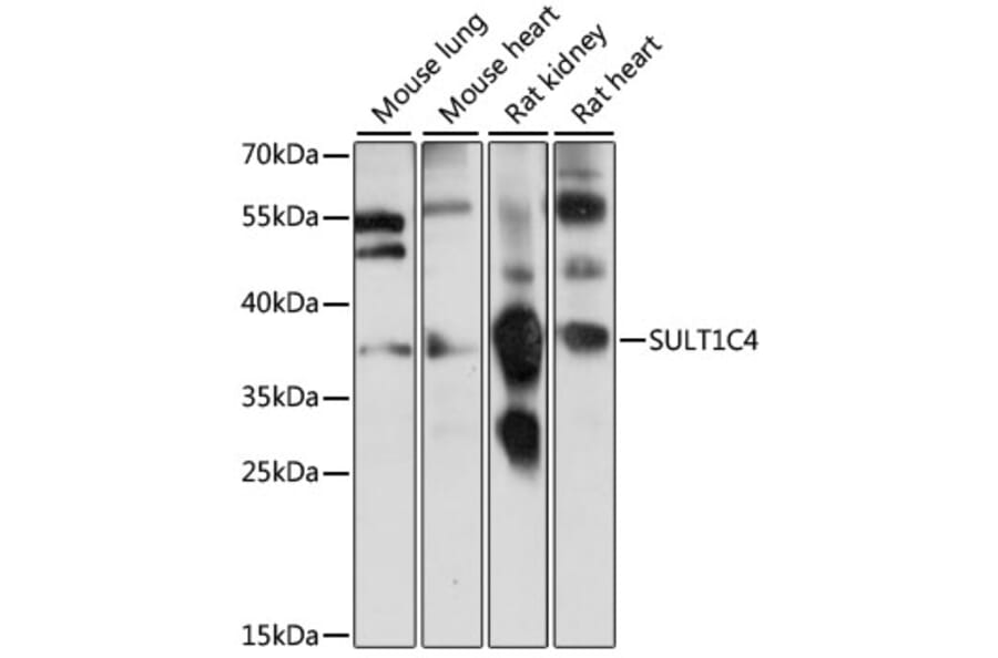 Western Blot - Anti-SULT1C4 Antibody (A89484) - Antibodies.com